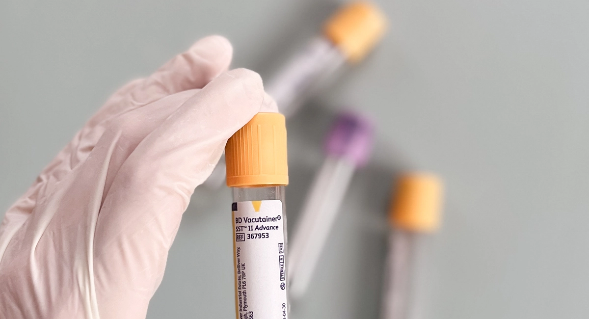 Overactieve darmen, wat houdt het in? Lees het hier! Overactieve darmen 2