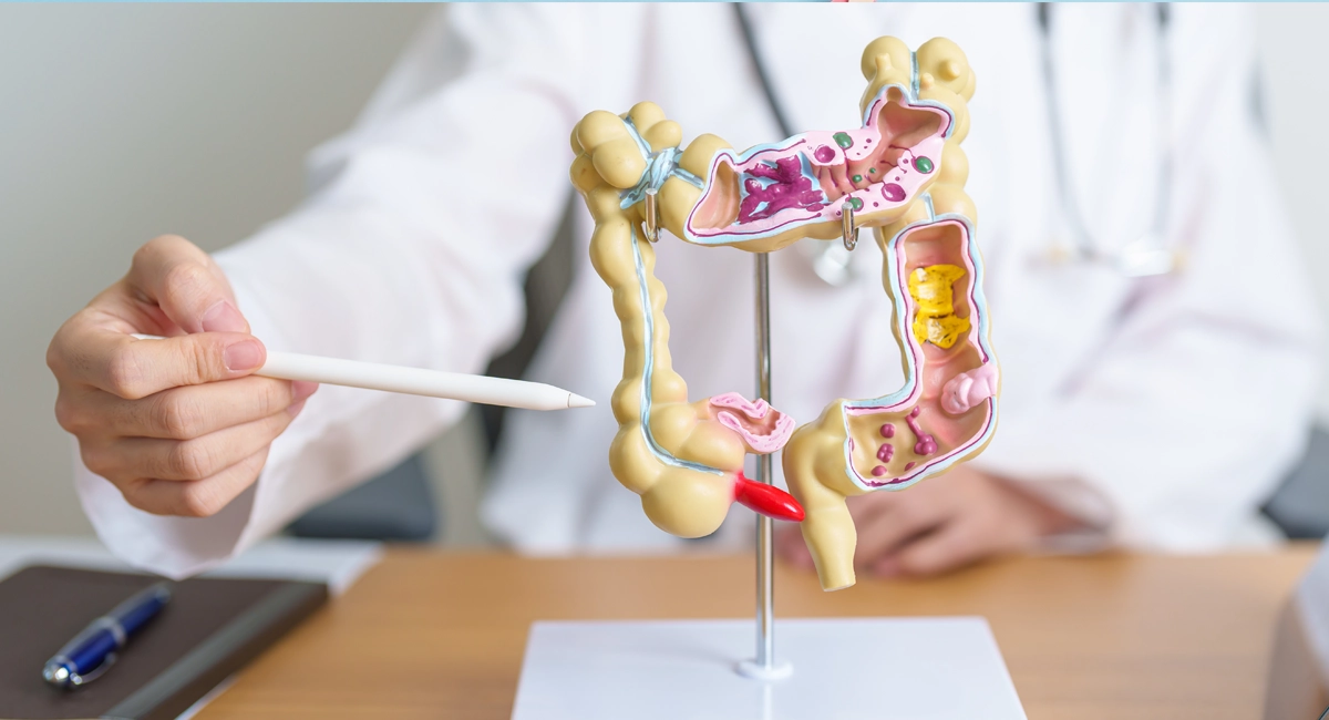 Een slechte stoelgang, wat kan ik eraan doen? slechte stoelgang 2